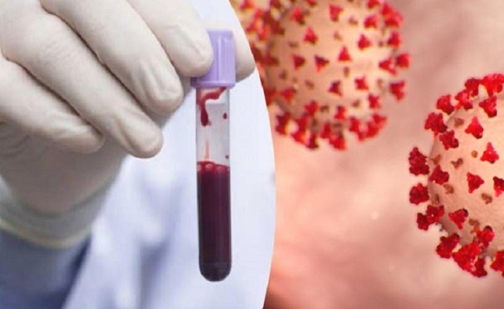 கிழக்கு பல்கலைக்கழக மாணவர்கள் மற்றும் பொலிஸார் உட்பட 11 பேருக்கு கொரோனா!