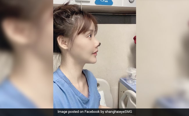 பிளாஸ்டிக் சத்திரசிகிச்சை பற்றி பிரபல சீன நடிகை எச்சரிக்கை