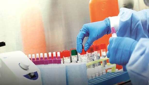 உலக அளவில் கொரோனாவால் பாதிப்பு அடைந்தோர் எண்ணிக்கை 17 கோடியை தாண்டியது!